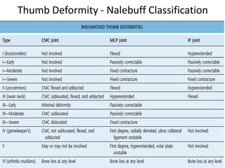 Thumb Deformity - Nalebuff Classification 
 