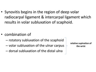 • Synovitis begins in the region of deep volar 
radiocarpal ligament & intercarpal ligament which 
results in volar subluxation of scaphoid. 
• combination of 
– rotatory subluxation of the scaphoid 
– volar subluxation of the ulnar carpus 
– dorsal subluxation of the distal ulna 
relative supination of 
the wrist 
 