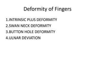 Deformity of Fingers 
1.INTRINSIC PLUS DEFORMITY 
2.SWAN NECK DEFORMITY 
3.BUTTON HOLE DEFORMITY 
4.ULNAR DEVIATION 
 