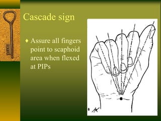 Cascade sign
♦ Assure all fingers
point to scaphoid
area when flexed
at PIPs
 