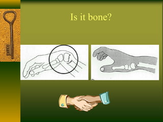Is it bone?
 