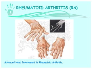 Hand and wrist examination