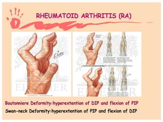 Hand and wrist examination