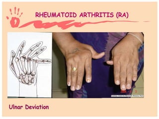 Hand and wrist examination
