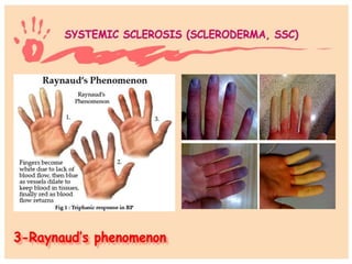 Hand and wrist examination