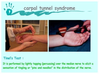 Hand and wrist examination