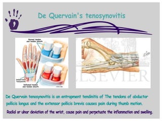 Hand and wrist examination