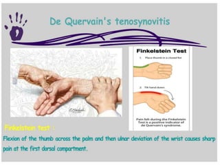 Hand and wrist examination