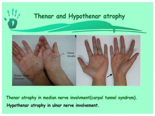 Hand and wrist examination