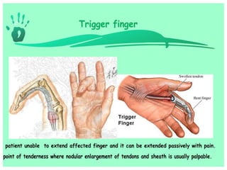 Hand and wrist examination