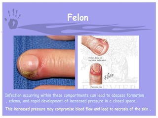 Hand and wrist examination