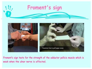 Hand and wrist examination