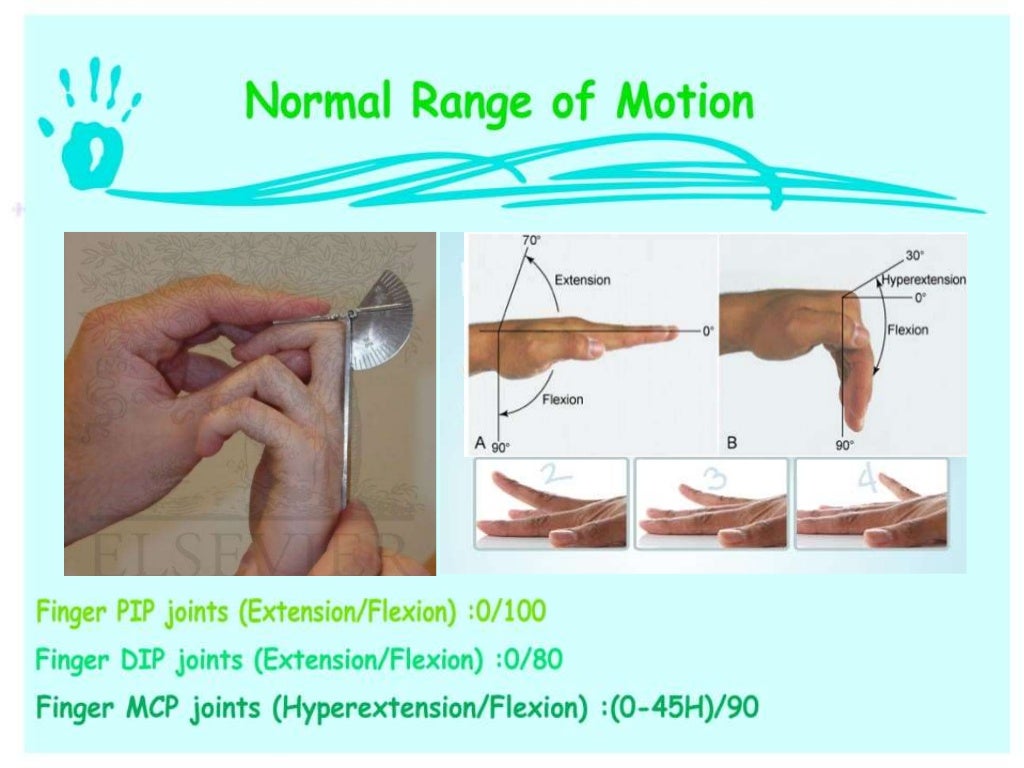Hand and wrist examination