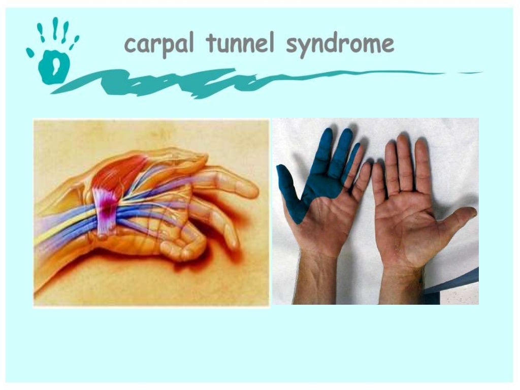 Hand and wrist examination