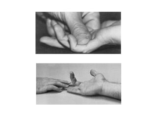 Hand Examination Example Examination of Hand | PPTX