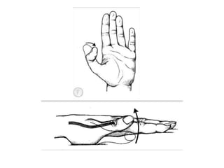 Hand Examination Example Examination of Hand | PPTX