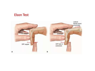 Hand Examination Example Examination of Hand | PPTX