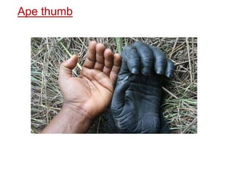Examination of Hand | PPTX