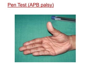 Examination of Hand | PPTX