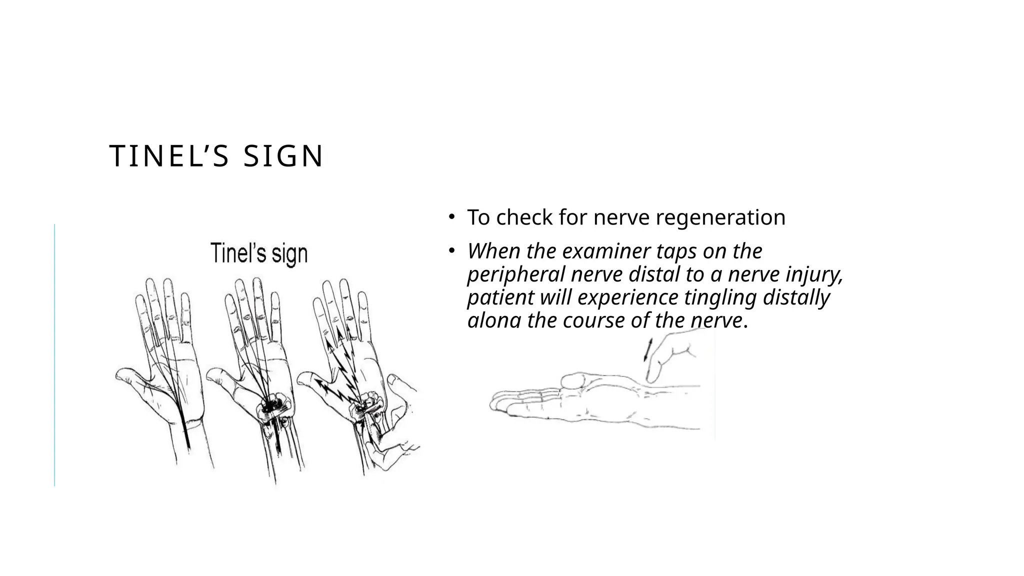 Seminar on the examination of Hands.pptx