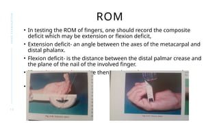 Seminar on the examination of Hands.pptx