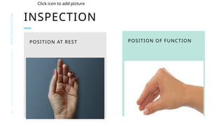 Hand Examination Example Seminar on the examination of Hands.pptx