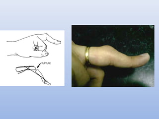 Hand Examination Example Hand examination | PPT