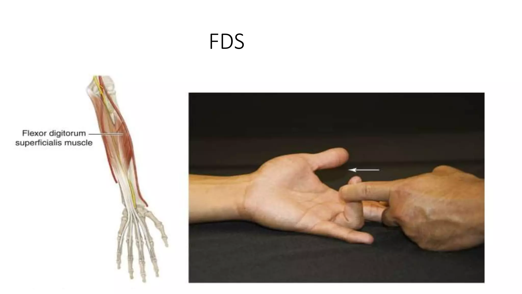 Hand examination.pptx