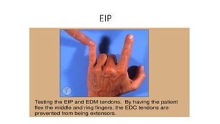 Hand Examination Example Hand examination.pptx