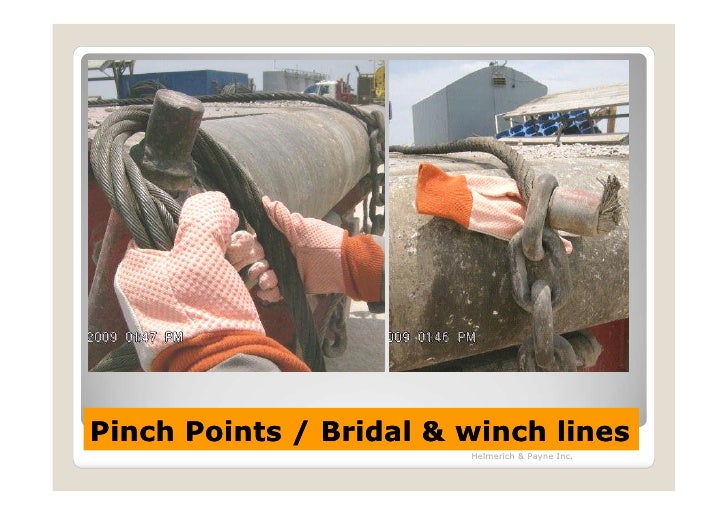 STRATAGIES FOR THE PREVENTION OF HAND INJURIES