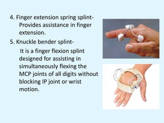 4. Finger extension spring splint-
Provides assistance in finger
extension.
5. Knuckle bender splint-
It is a finger flexion splint
designed for assisting in
simultaneously flexing the
MCP joints of all digits without
blocking IP joint or wrist
motion.
 