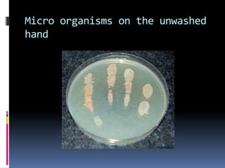 Hand hygiene | PPTX