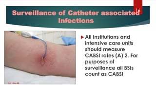 Hand hygiene and prevention of infection in ICU Care | PDF