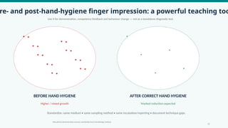 re- and post-hand-hygiene finger impression: a powerful teaching too
Use it for demonstration, competency feedback and behaviour change — not as a standalone diagnostic test.
BEFORE HAND HYGIENE
Higher / mixed growth
AFTER CORRECT HAND HYGIENE
Marked reduction expected
Standardize: same medium • same sampling method • same incubation/reporting • document technique gaps.
12
Educational demonstration concept; standardize local microbiology method.
 