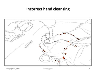 Incorrect hand cleansing
Friday, April 21, 2023 Hand Hygiene 10
 