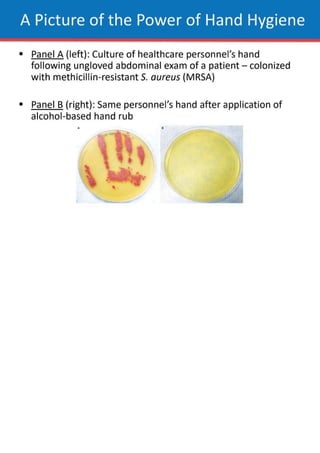 hand hygiene assignments for students . | PDF