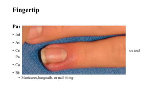 hand infectionby drbedrumohanmedgsr.pptx