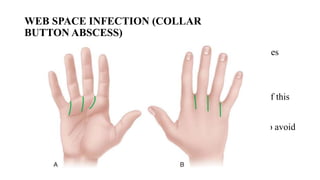 hand infectionby drbedrumohanmedgsr.pptx