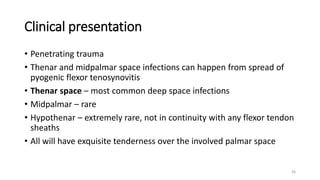 Hand Infection .pptx