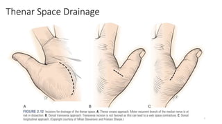 Hand Infection .pptx