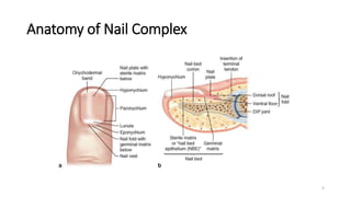 Hand Infection .pptx