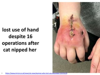 lost use of hand
despite 16
operations after
cat nipped her
• https://www.mirror.co.uk/news/uk-news/woman-who-lost-use-wounded-13374119
 