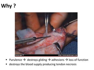 Why ?
 Purulence  destroys gliding  adhesions  loss of function
 destroys the blood supply producing tendon necrosis
 