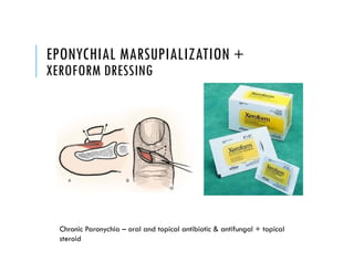EPONYCHIAL MARSUPIALIZATION +
XEROFORM DRESSING
Chronic Paronychia – oral and topical antibiotic & antifungal + topical
steroid
 