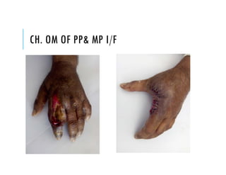 CH. OM OF PP& MP I/F
 