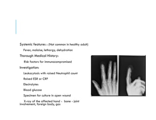 Systemic features : (Not common in healthy adult)
Fever, malaise, lethargy, dehydration
Thorough Medical History:
Risk factors for immunocompromised
Investigation:
Leukocytosis with raised Neutrophil count
Raised ESR or CRP
Electrolytes
Blood glucose
Specimen for culture in open wound
X-ray of the affected hand - bone - joint
involvement, foreign body, gas
 