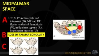 MIDPALMAR
SPACE
• 3rd & 4th metacarpals and
interossei (D), MF and RF
flexor tendons & lumbricals
(V), midpalmar septum (R),
hypothenar muscles (U)
Loss of palmar concavity lost
A
B
C
LOSS OF PALMAR CONCAVITY
 