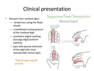 Clinical presentation 
• Kanavel's four cardinal signs: 
– tenderness along the flexor 
sheath 
– a semiflexed resting posture 
of the involved digit 
– symmetric digital swelling 
(sausage digit),fusiform 
swelling 
– pain with passive extension 
of the digit (the most 
reproducible clinical sign), 
*Not all signs may be 
present 
 