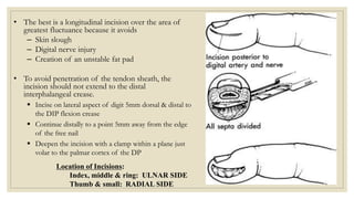 Racket Incision Digits Hand infections | PPTX