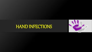 HAND INFECTIONS
 